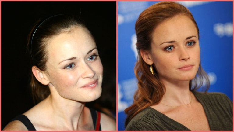 alexis bledel krankheit